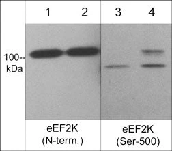 Anti-eEF2K (Ser-500), Phosphospecific Antibody - Image 2