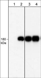 Anti-EGFR (Tyr-1101), Phosphospecific Antibody