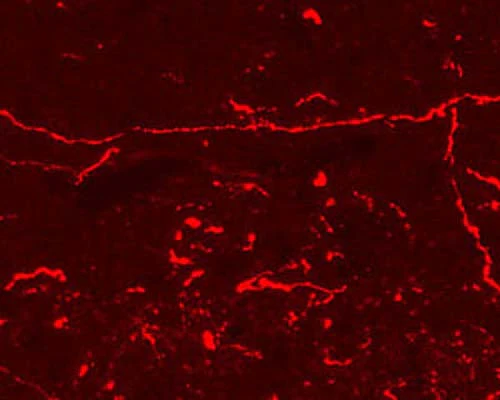 Anti-Endomorphin-1 and Endomorphin-2 (E-1/E-2) Antibody
