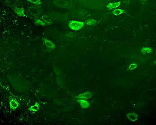 Anti-Endomorphin-1 (E-1) Antibody