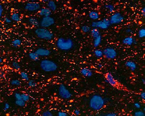Anti-Endomorphin-2 (E-2) Antibody
