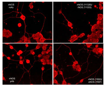 Anti-eNOS (Tyr-657)/nNOS (Tyr-895), Phosphospecific Antibody - Image 2