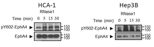 Anti-EphA4 (Tyr-602) [conserved site], Phosphospecific Antibody - Image 5