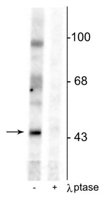 Anti-EphrinB (Tyr331) Antibody