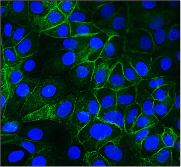 Anti-Epithelial Cell Adhesion Molecule (Ep-CAM) Antibody