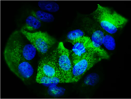 Anti-Epithelial Membrane Antigen (EMA)