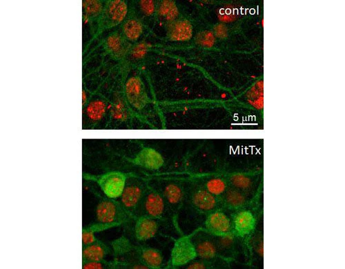 Anti-ERK1/2 (MAPK) (Thr202/Tyr204) Antibody - Image 3