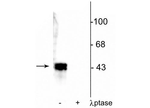 Anti-ERK1/2 (MAPK) (Thr202/Tyr204) Antibody - Image 4