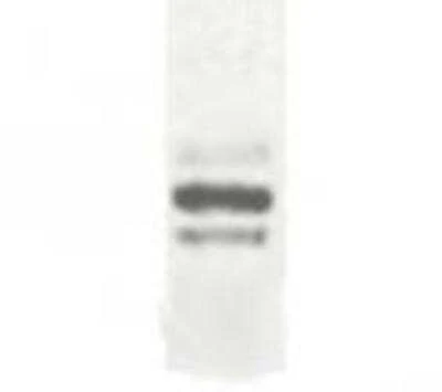 Anti-ESDN Antibody