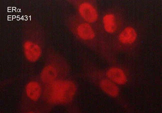 Anti-Estrogen Receptor α (C-terminus) Antibody - Image 2