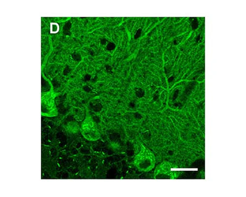 Anti-Eukaryotic translation initiation factor 2C (elF2c) Antibody - Image 2