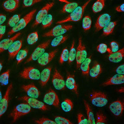 Anti-EWS Antibody - Image 2