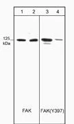 Anti-FAK (Tyr-397), Phosphospecific Antibody