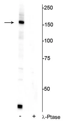 Anti-FANCI (Ser556) Antibody
