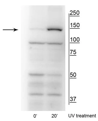 Anti-FANCI (Ser559) Antibody - Image 2