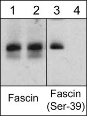 Anti-Fascin (Ser-39), Phosphospecific Antibody