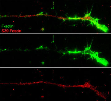 Anti-Fascin (Ser-39), Phosphospecific Antibody - Image 2