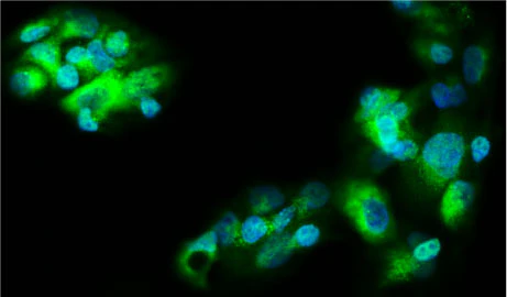 Anti-Ferritin Antibody