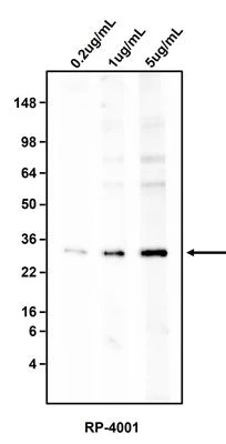 Anti-Ferritin Antibody - Image 2