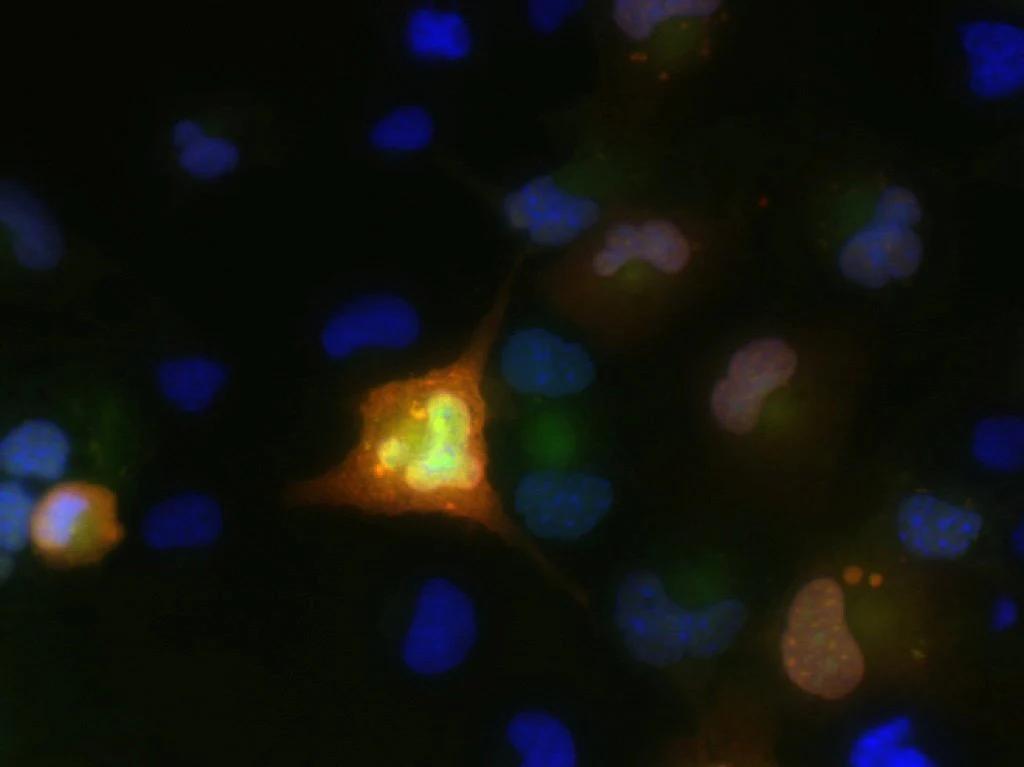 Anti-FGF12/FHF1 Antibody