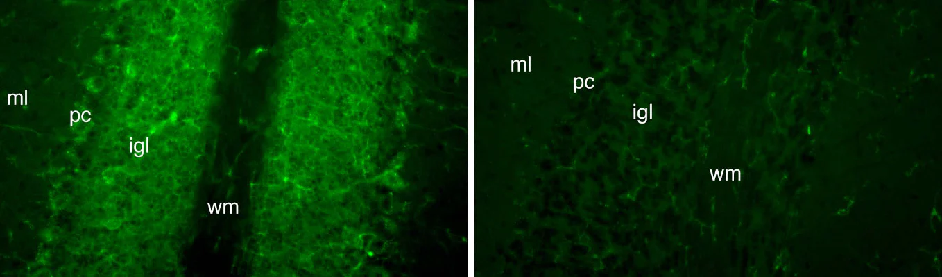 Anti-FGF14/FHF4 Antibody