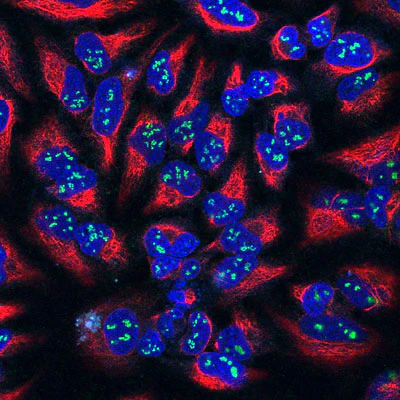 Anti-Fibrillarin Antibody