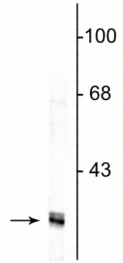 Anti-Fibrillarin Antibody - Image 2