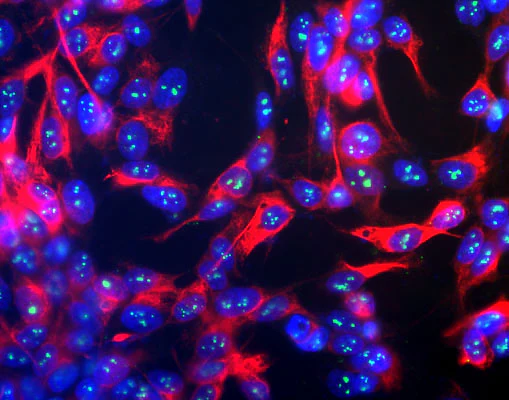 Anti-Fibrillarin Antibody - Image 3