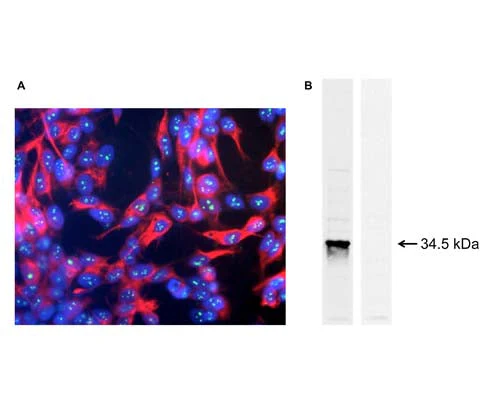 Anti-Fibrillarin (Nop1p) Antibody