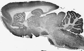 Anti-Fig4/Sac3 Antibody - Image 2