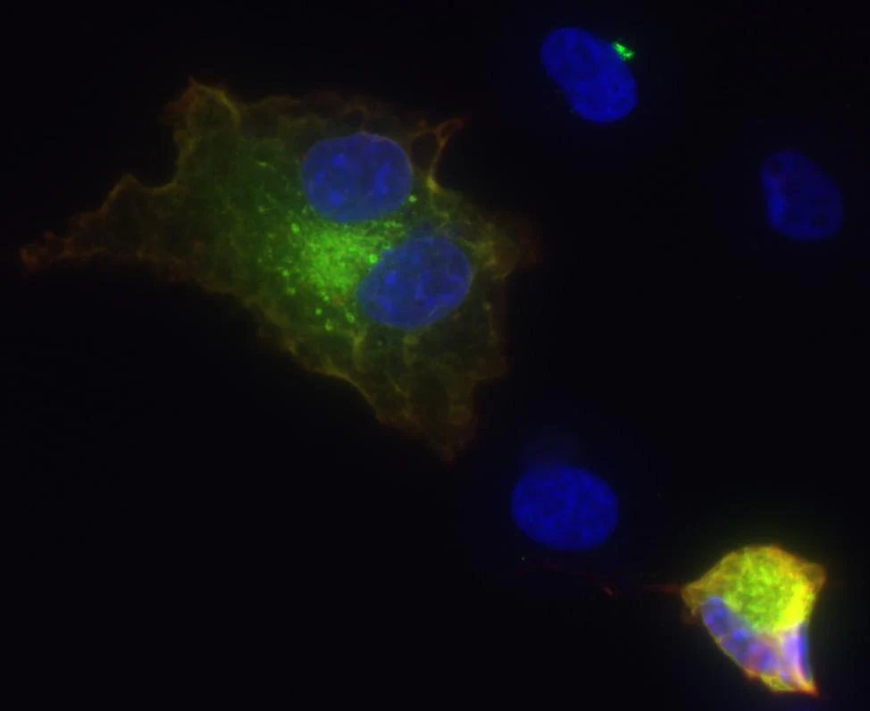 Anti-Flrt3 Antibody