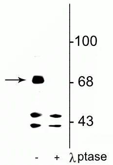Anti-FMRP (Ser499) Antibody