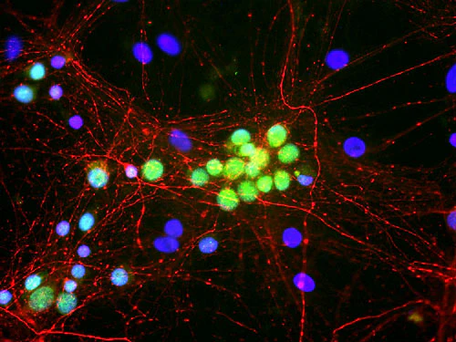 Anti-FOX1 Antibody - Image 2