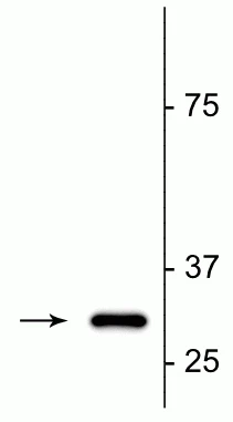Anti-Fractin Antibody