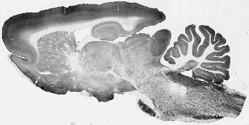 Anti-GABA-A-R, Alpha1 Antibody - Image 3