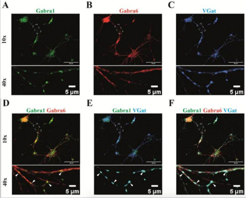 Anti-GABA-A-R, Alpha1 Antibody - Image 5