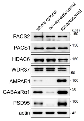 Anti-GABA-A-R, Alpha1 Antibody - Image 6