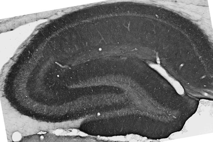 Anti-GABA-A-R-Alpha2 Antibody - Image 2