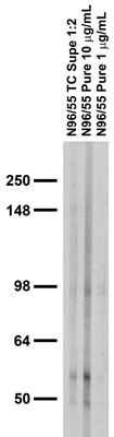 Anti-GABA-A-R, Beta1 Antibody