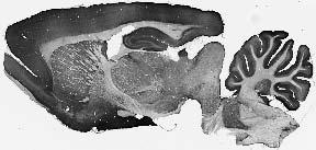 Anti-GABA-A-R, Beta1 Antibody - Image 3