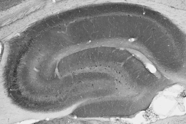 Anti-GABA-A-R, Beta3 Antibody - Image 3