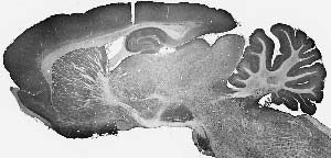 Anti-GABA-A-R, Beta3 Antibody - Image 4