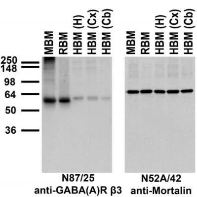 Anti-GABA-A-R, Beta3 Antibody - Image 5