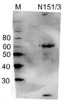 Anti-GABA-A-R, Delta Antibody