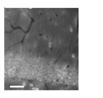 Anti-GABA-A-R, Delta Antibody - Image 3