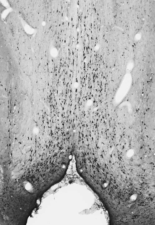 Anti-GABA-A-R-Epsilon Antibody