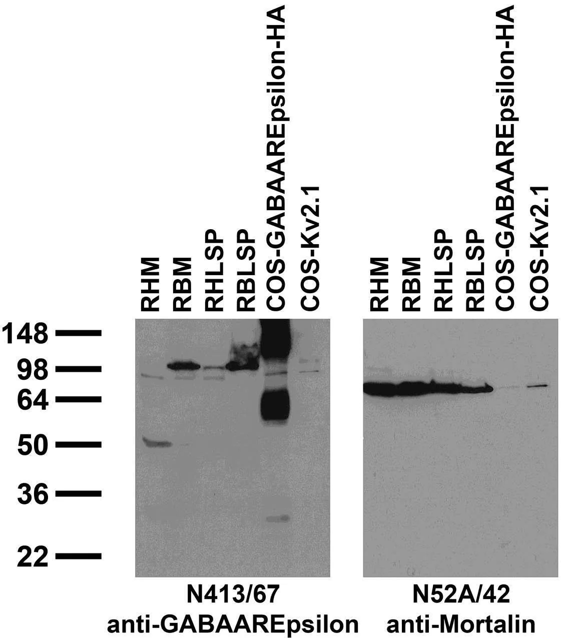 Anti-GABA-A-R-Epsilon Antibody - Image 2