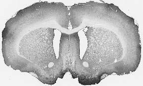Anti-GABA-A-R-Epsilon Antibody - Image 3