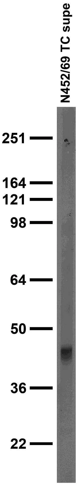 Anti-GABA-A-R-Gamma2L Antibody