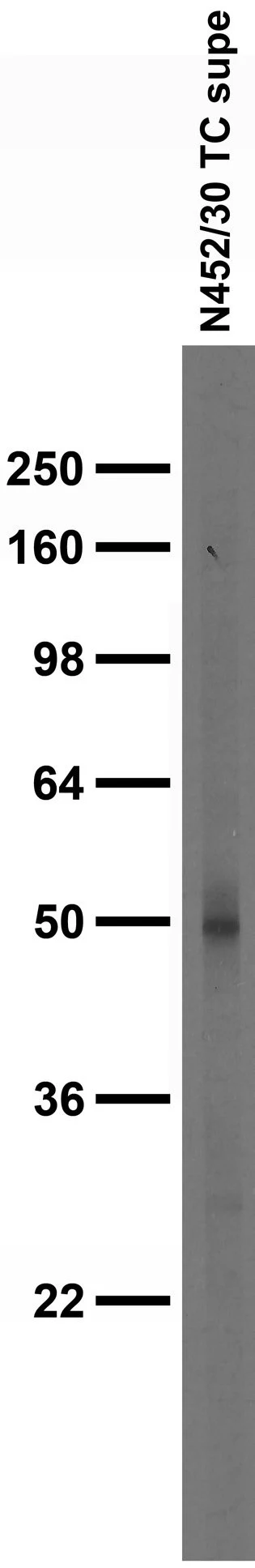 Anti-GABA-A-R-Gamma2L/S Antibody - Image 2